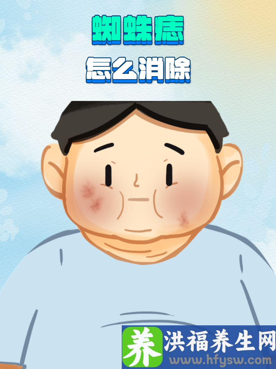 蜘蛛痣怎么消除？有效方法快快码住