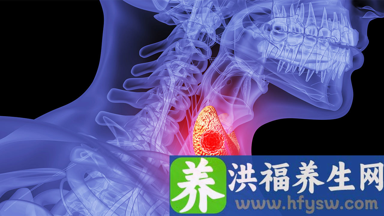 甲亢突眼冰敷还是热敷