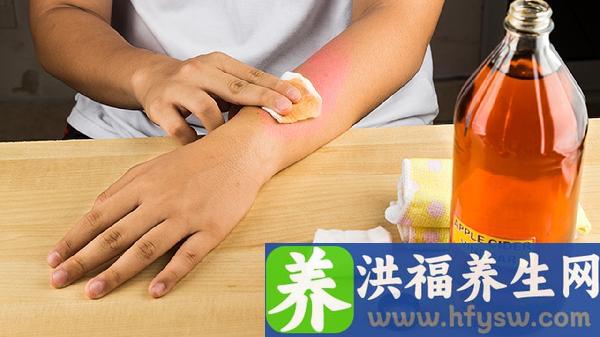 刮完腋毛可以用碘伏擦一下吗