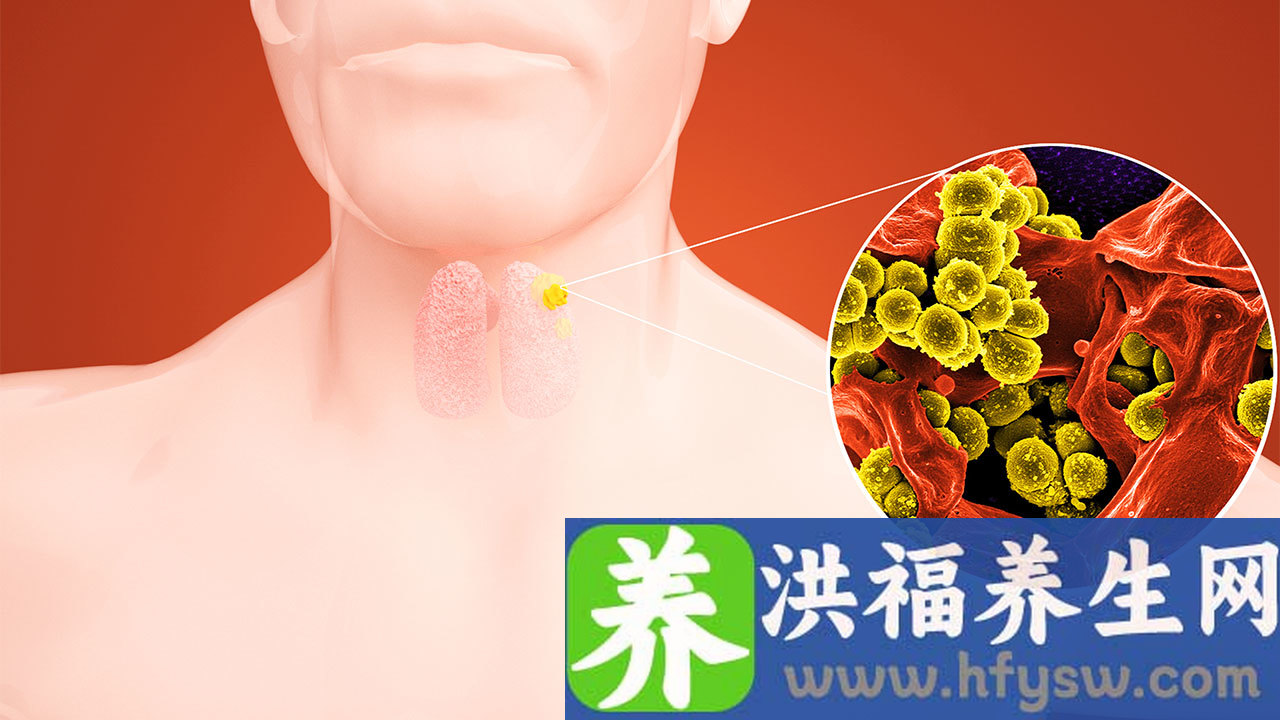 甲状腺功能减退的初期症状