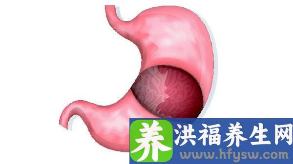 胃癌晚期割掉全胃能活多久
