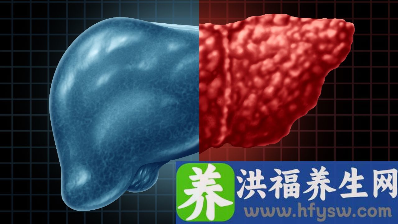 肝病的表现是什么