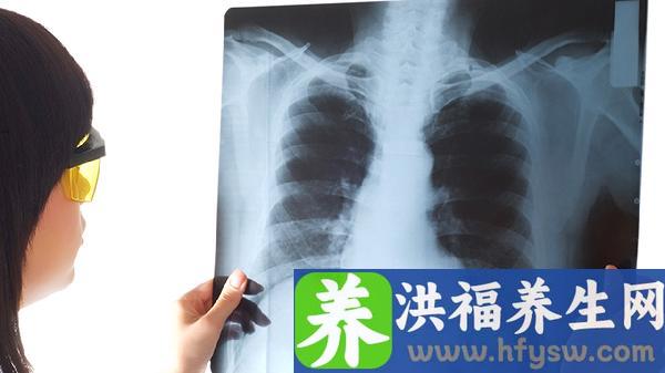 有肺癌晚期抗癌成功的人吗