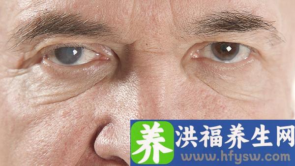 戴隐形眼镜会引起飞蚊症吗