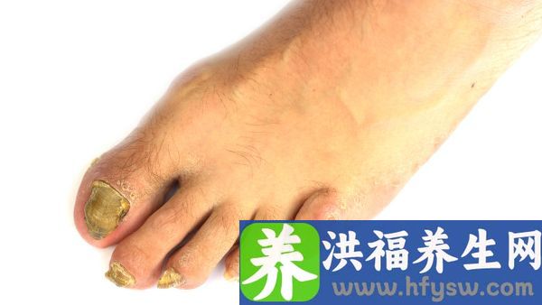 突然一个脚趾僵硬怎么办