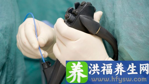 胃痉挛要做胃镜吗