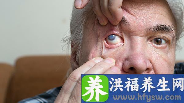 老年人眼睛干涩是怎么回事