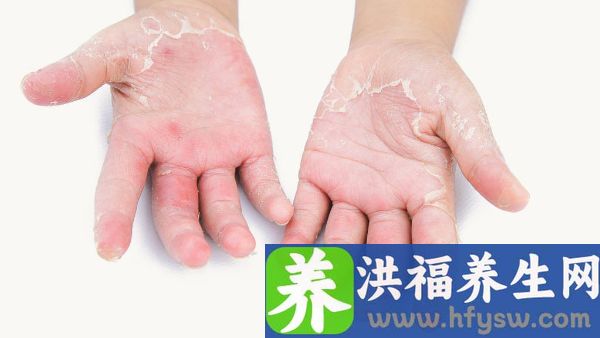手发麻是什么原因引起的