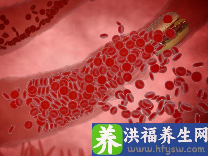 红薯，是高血脂的“发物”？警惕：这3物，请尽量撤下餐桌