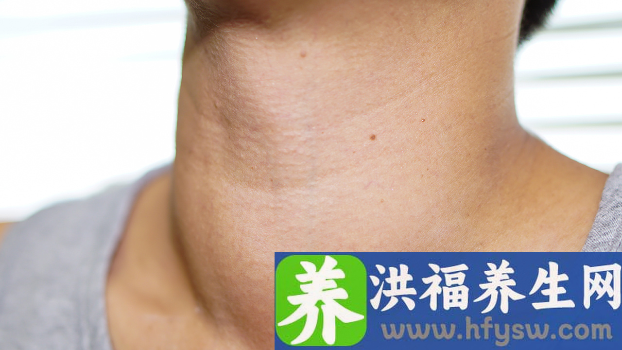 如何检查念珠菌感染