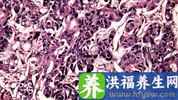 细菌前列腺炎吃吃什么药