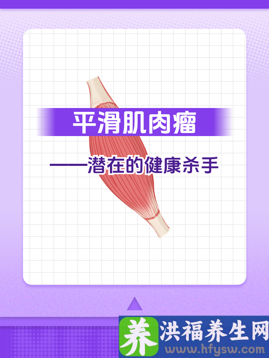 平滑肌肉瘤——潜在的健康杀手