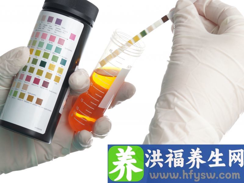 尿检的意义