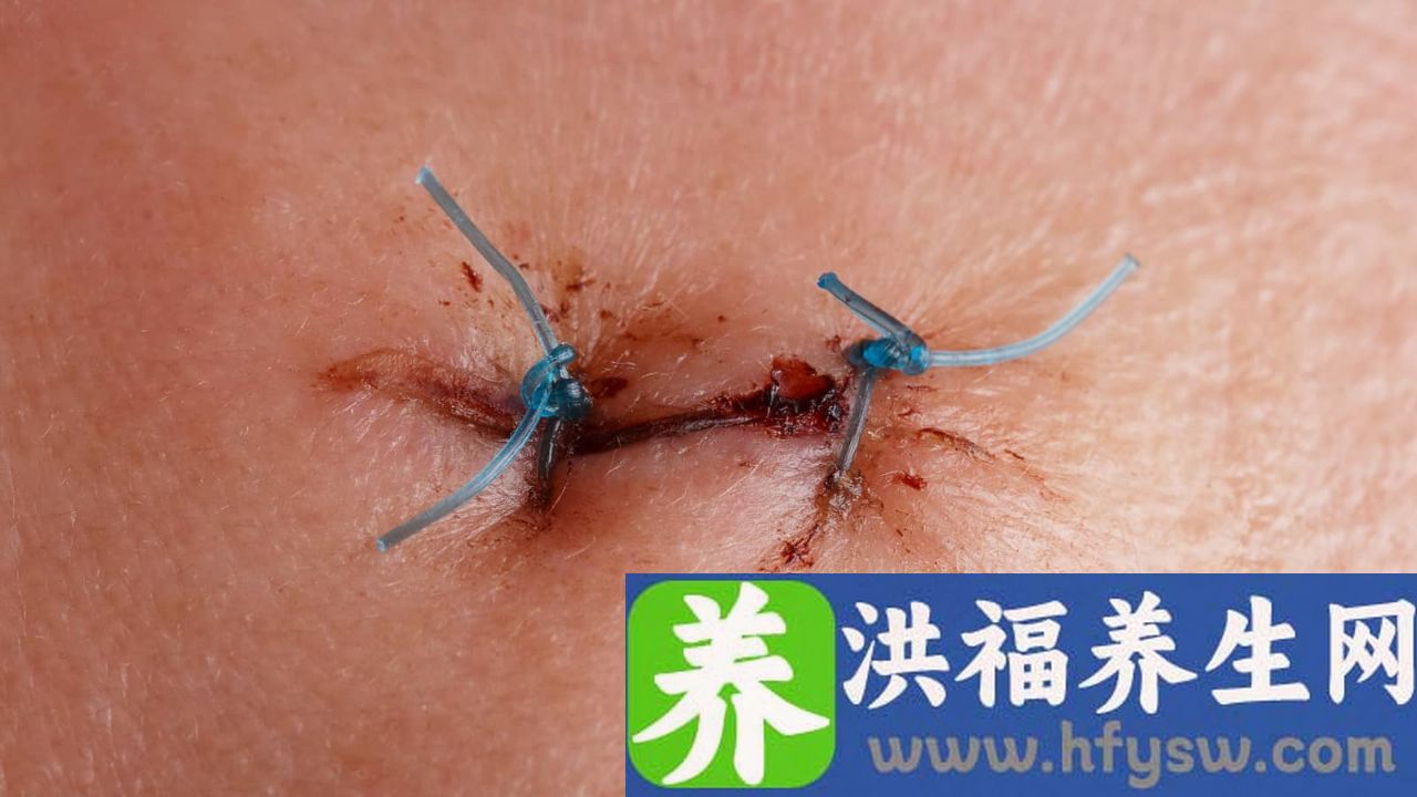 糖尿病伤口愈合慢的原因有哪些
