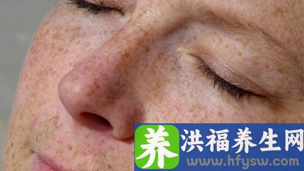 避孕药是否会影响以后怀孕？盘点关于避孕药的3个问题！
