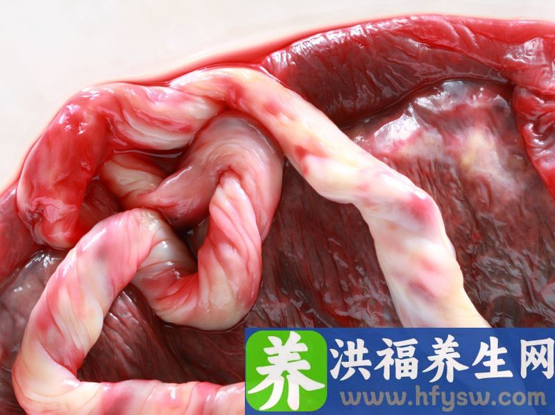 幽门梗阻的症状