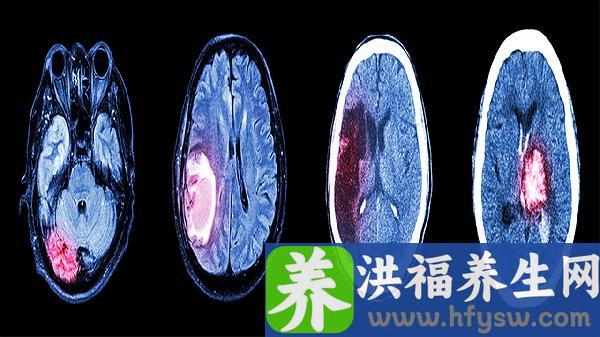 特重型颅脑损伤清醒期怎样治疗
