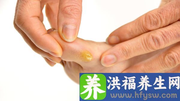 脚趾走得太久头麻了一个月怎么办
