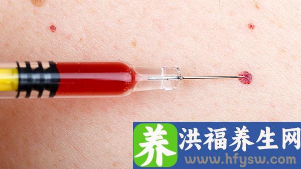蛛网膜下腔出血CTA注意事项