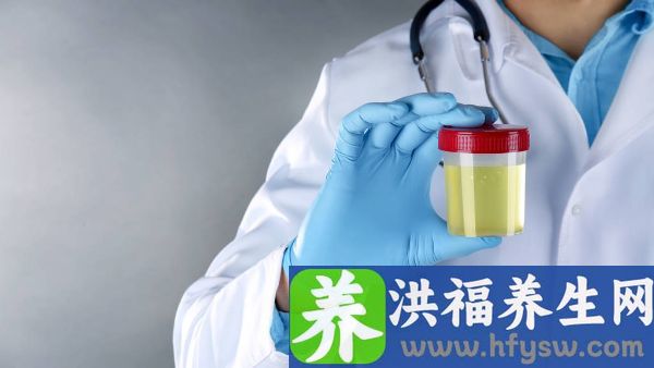 尿常规白细胞81严重吗