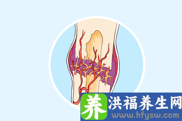 骨折了吃什么好的最快