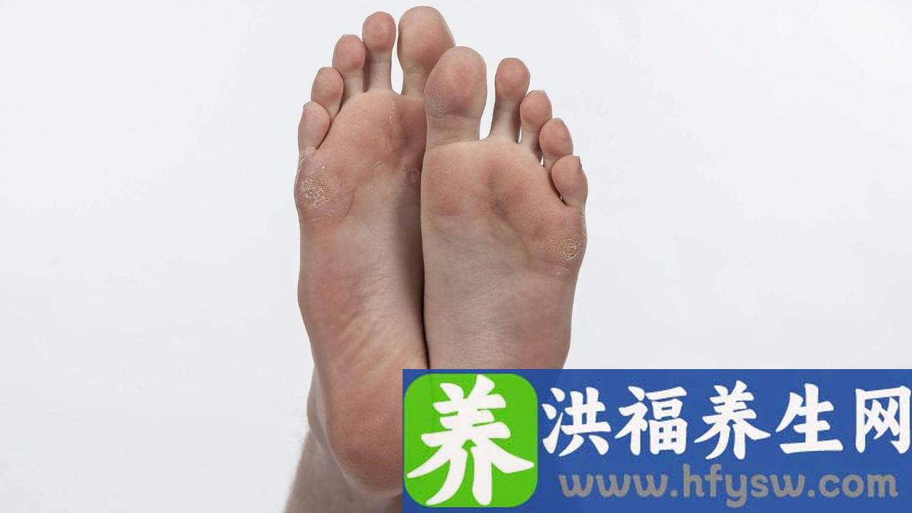 脚底突然痛起来什么原因