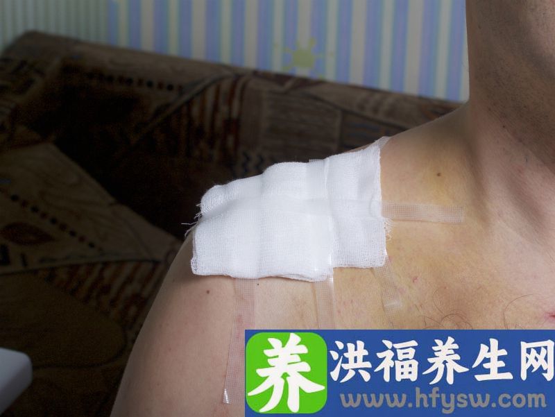 锁骨是什么意思