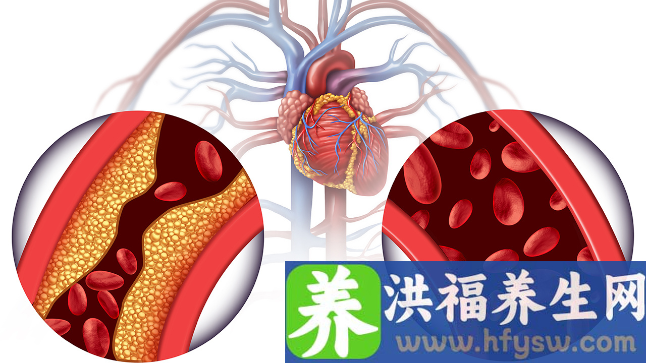 如何锻炼后循环缺血