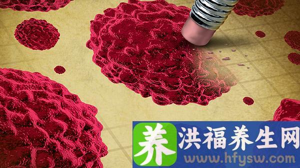 成人感染诺如病毒的症状是什么