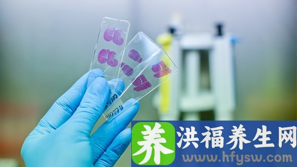 生理期外阴痒是怎么回事！先检查自身这三个地方！