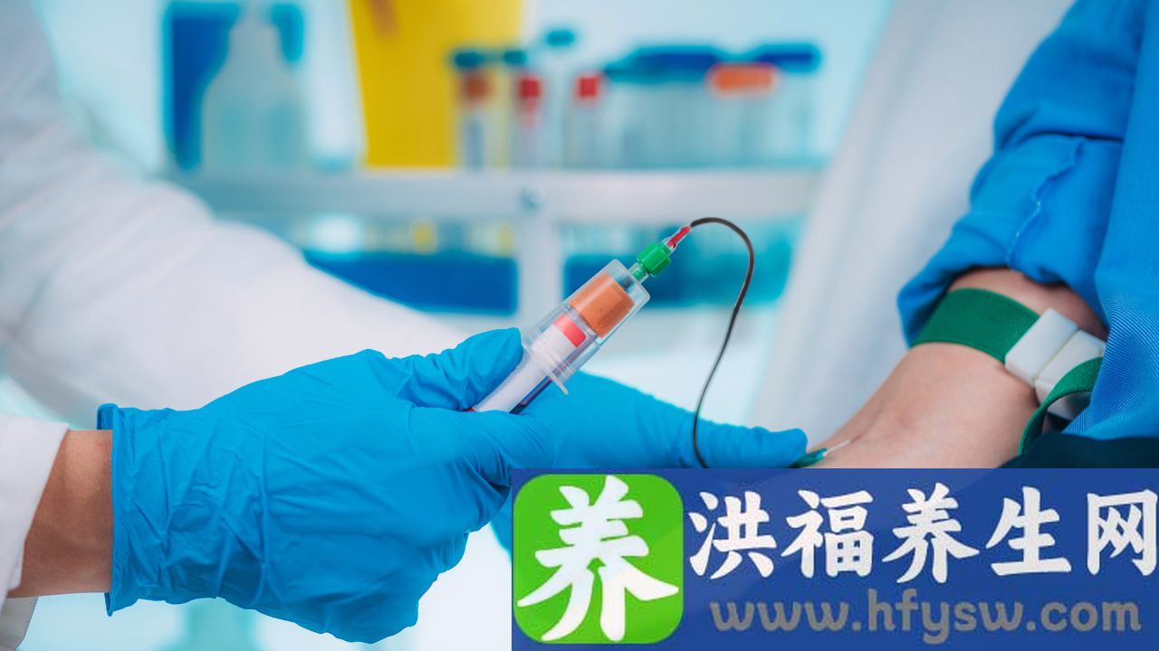空腹抽血要空腹几小时