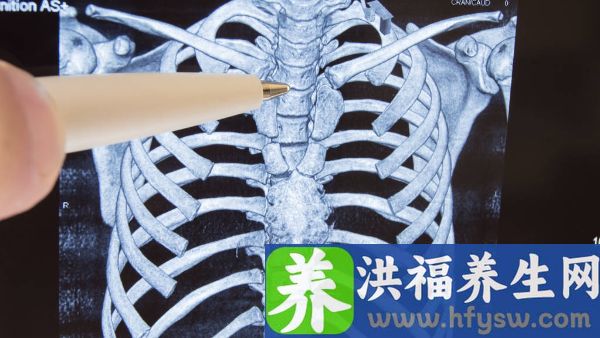 做加强CT对人体有什么危害