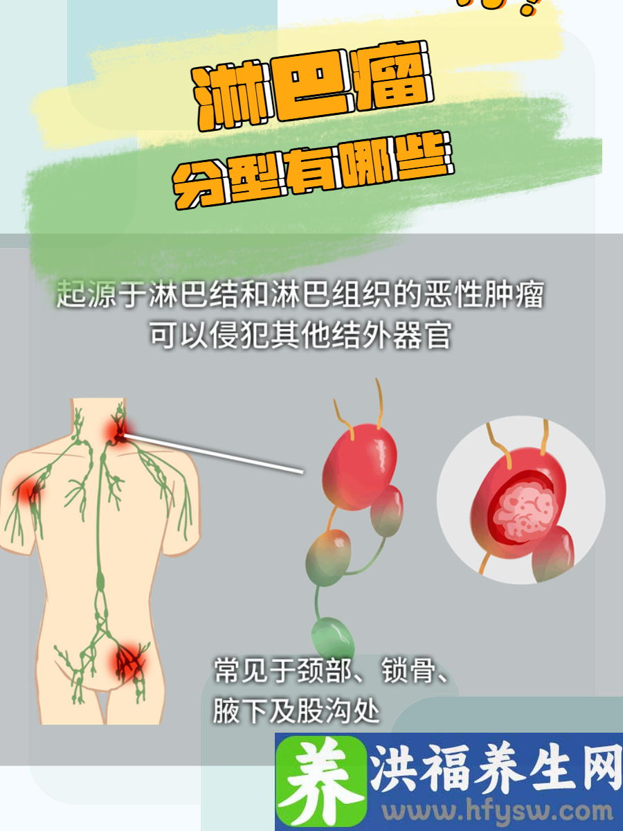 淋巴瘤分型有哪些？了解不同类型的淋巴瘤