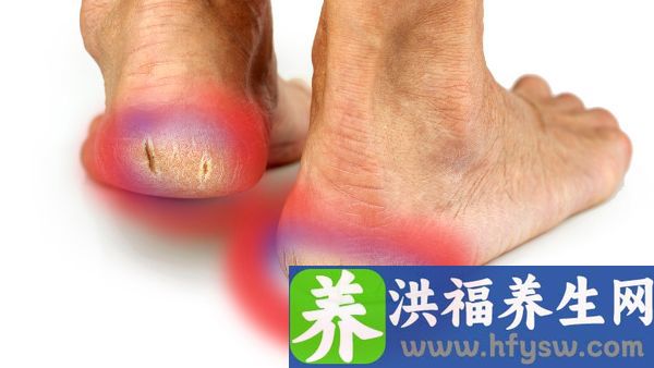 脚后跟一按就疼的原因