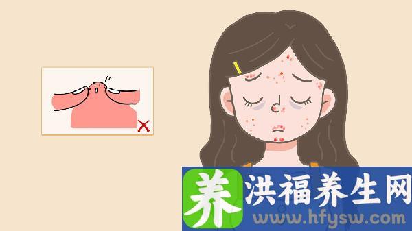 腮帮子脖子长痘痘怎么回事