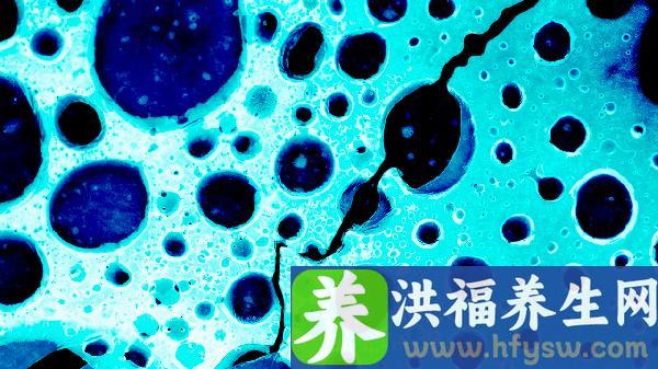 接触到诺如病毒感染者的粪便或者呕吐物会感染吗