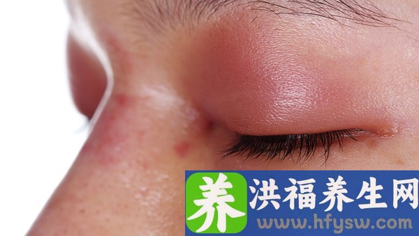 奥美定的作用是什么？面部奥美定取出的三个步骤