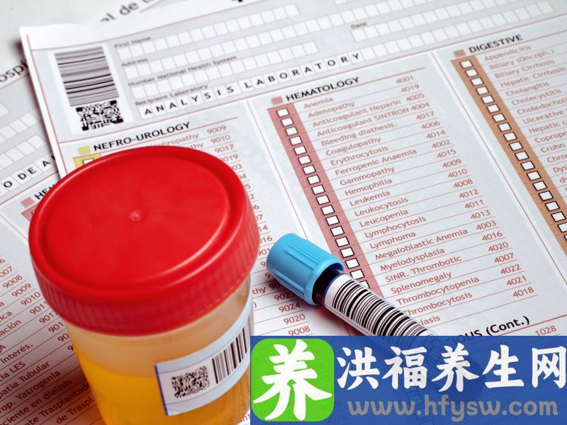尿液出现糖味和臭鸡蛋味，要警惕可能是疾病的征兆