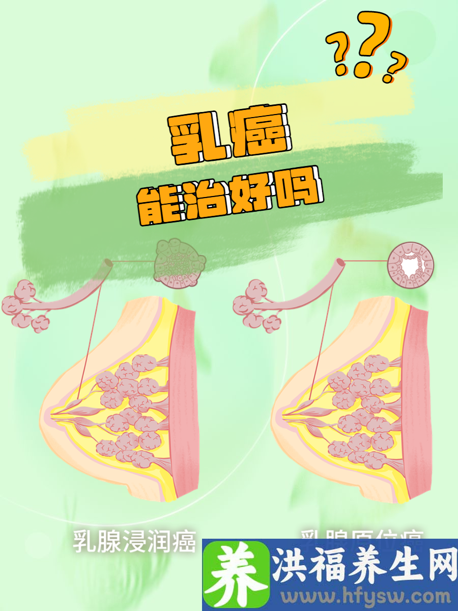乳癌能治好吗？解答治疗前景