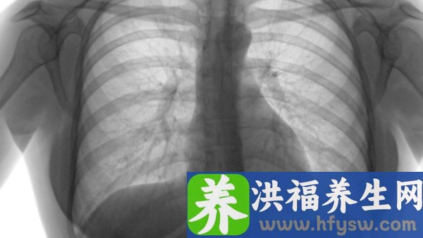 肺气虚最好的中成药有哪些 补肺丸效果好吗