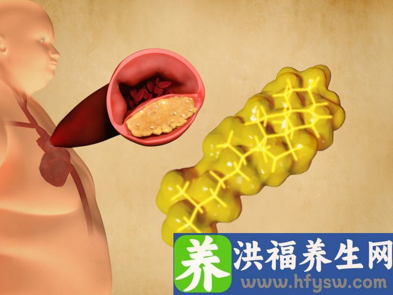 甘油三酯没超过这1个数，不用吃药，按这5个步骤，或可降低