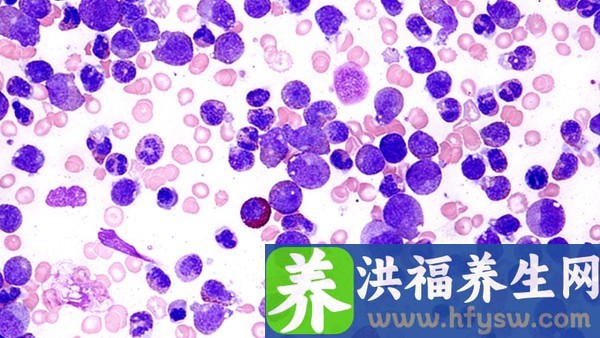法罗培南钠片是抗病毒的药吗 法罗培南钠片的作用是什么？