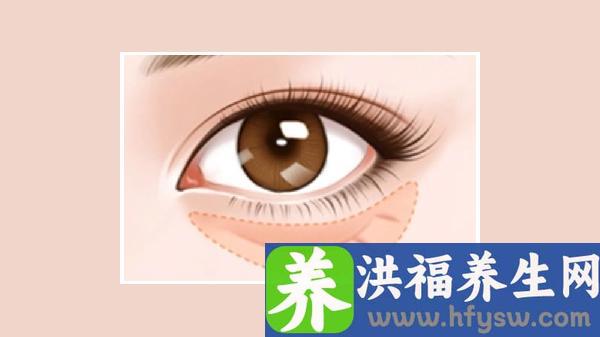 超声法祛眼袋的效果怎么样