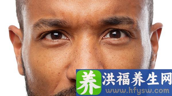 眼睑内翻矫正手术有哪些后遗症？