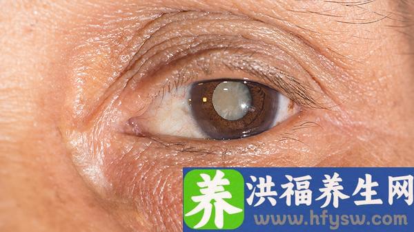 中老年如何保护视力和眼睛健康