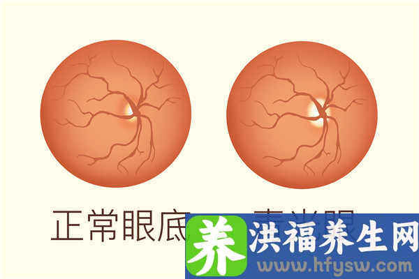 老年人可以做哪些身体检查？