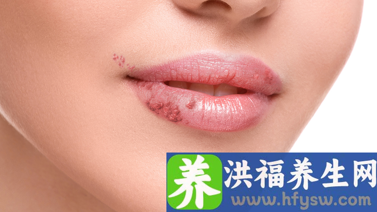 女性生殖器疱疹的3个危害 女性生殖器疱疹的危害有哪些