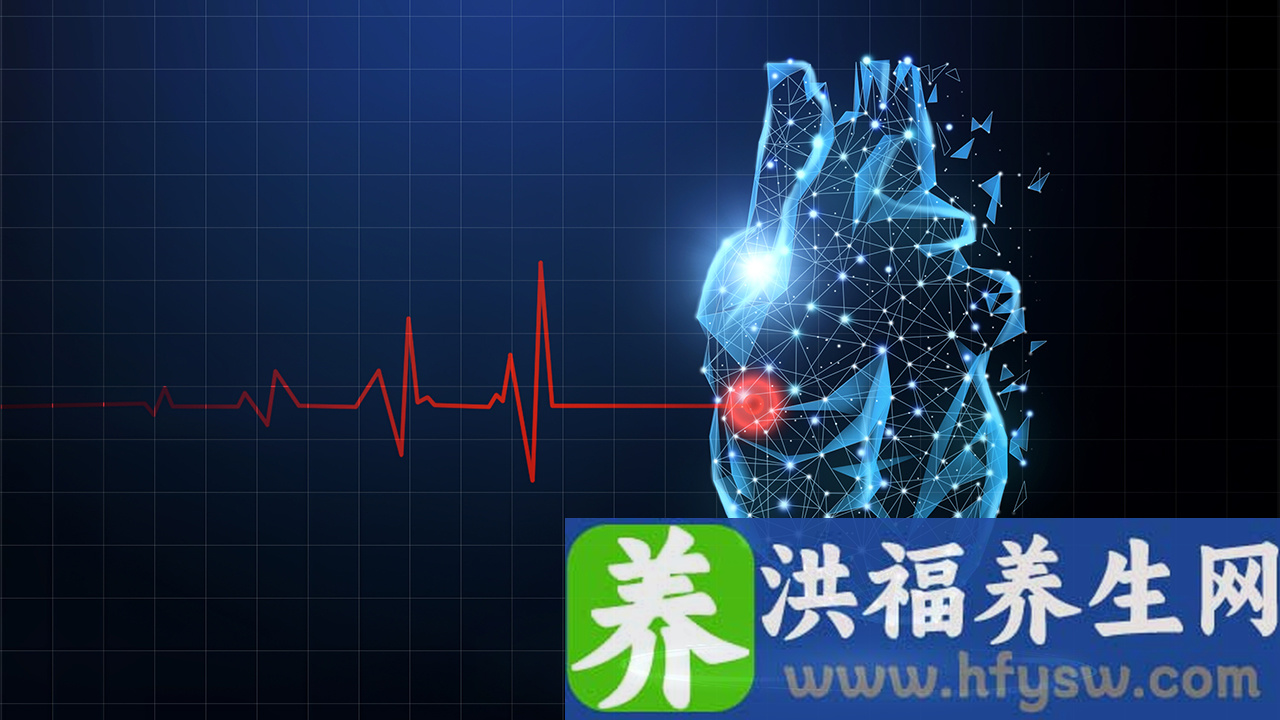 心脏CT是什么
