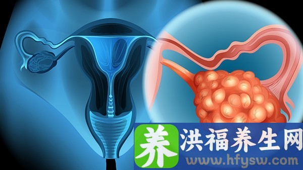 宫颈尖锐湿疣会有什么反应