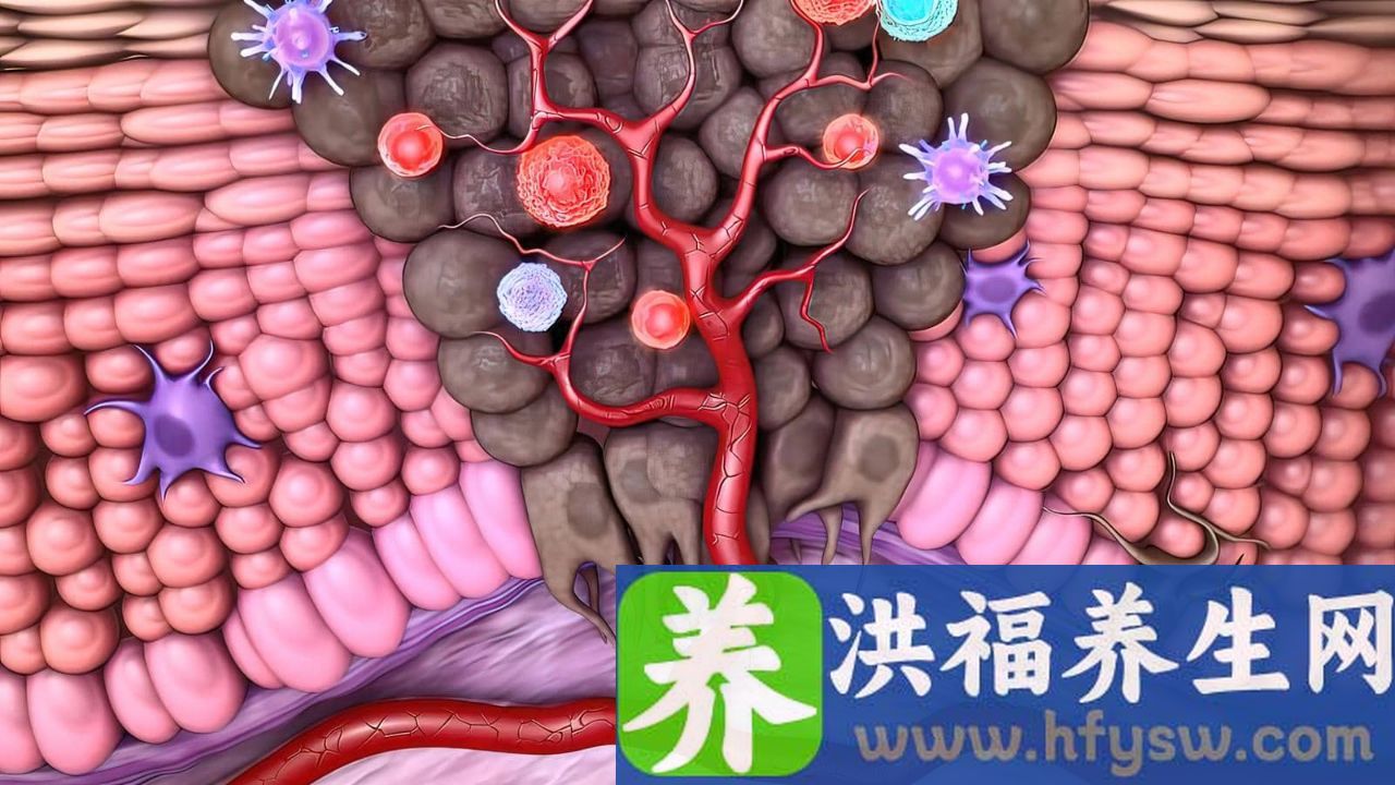 脑肿瘤是什么原因引起的